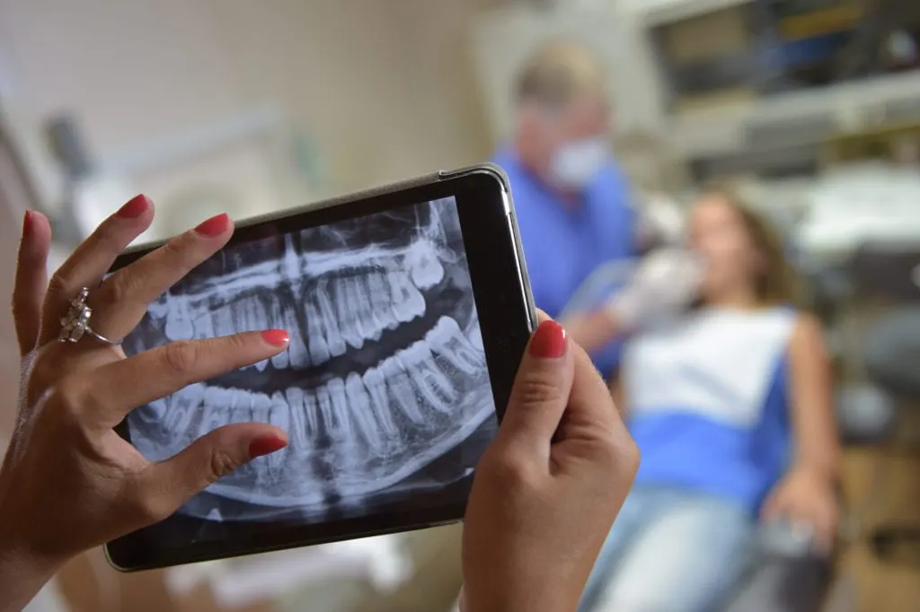Tooth Extractions in Chicago, Illinois