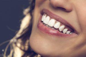 Porcelain Veneers vs. Dental Crowns