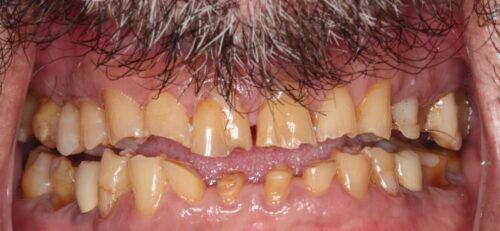 before cosmetic dentistry in Chicago, IL