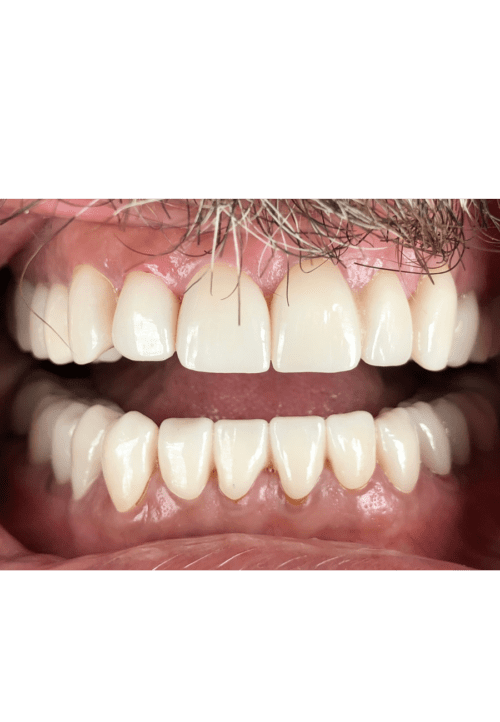 cosmetic dentistry results in Chicago, IL