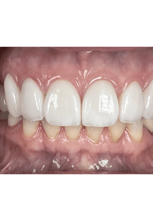 cosmetic dentistry results in Chicago, IL