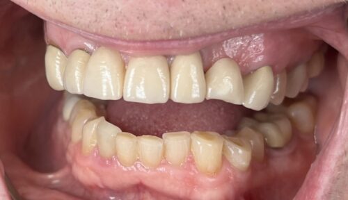 before cosmetic dentistry in Chicago, IL