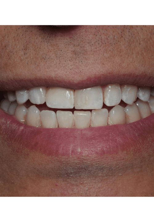 cosmetic dentistry results in Chicago, IL
