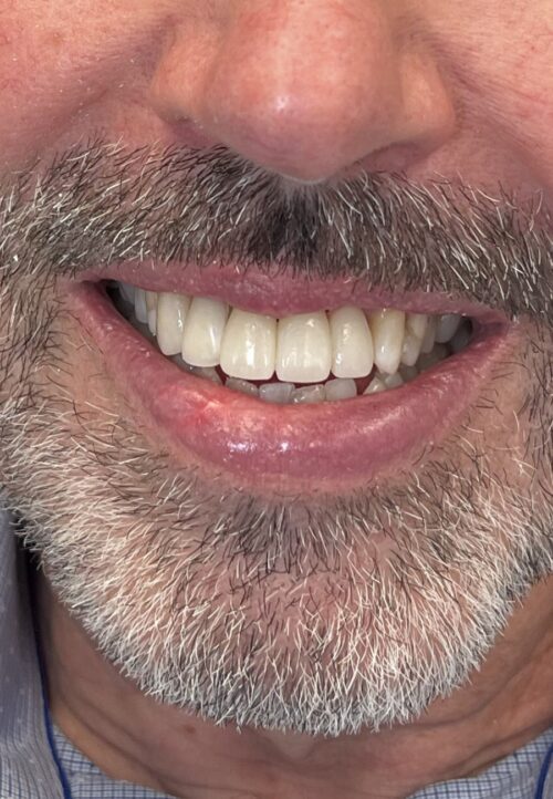 cosmetic dentistry results in Chicago, IL