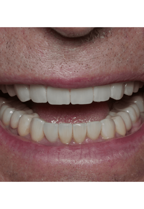 cosmetic dentistry results in Chicago, IL