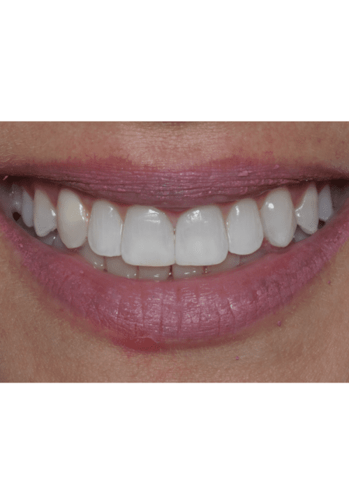 cosmetic dentistry results in Chicago, IL