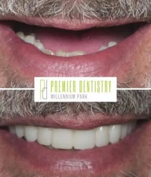 Premier chicago 33 - Cosmetic Dentistry Before & After Photos