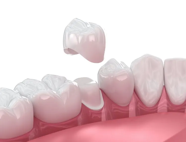 With the right habits and a bit of awareness, you can extend the life of your new dental crown significantly.