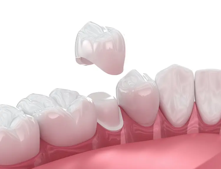 With the right habits and a bit of awareness, you can extend the life of your new dental crown significantly.